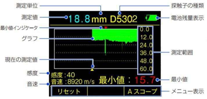 Bスコープ表示