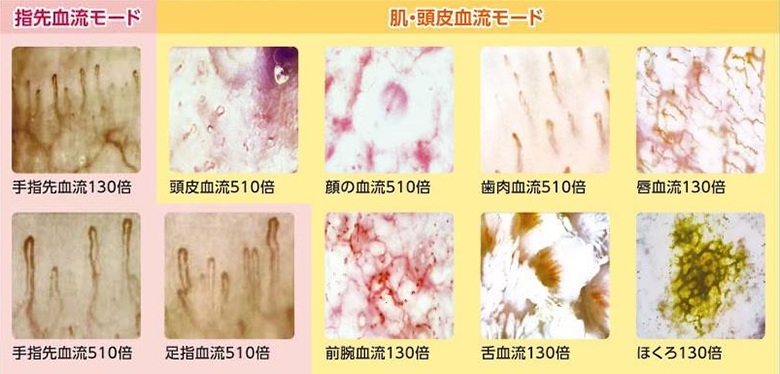 ①指先血流モード ②肌・頭皮血流モード