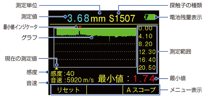 Bスコープ表示