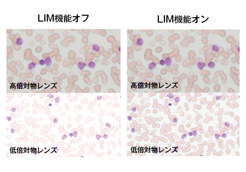 表示例